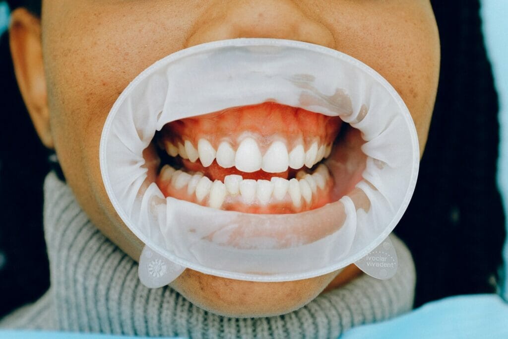 What Effect Does Coffee Have On Oral Health?
